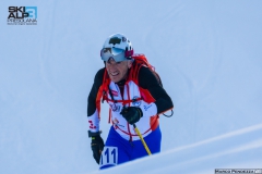 128-SKIALP3MP