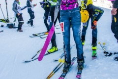 188-SKIALP3MP